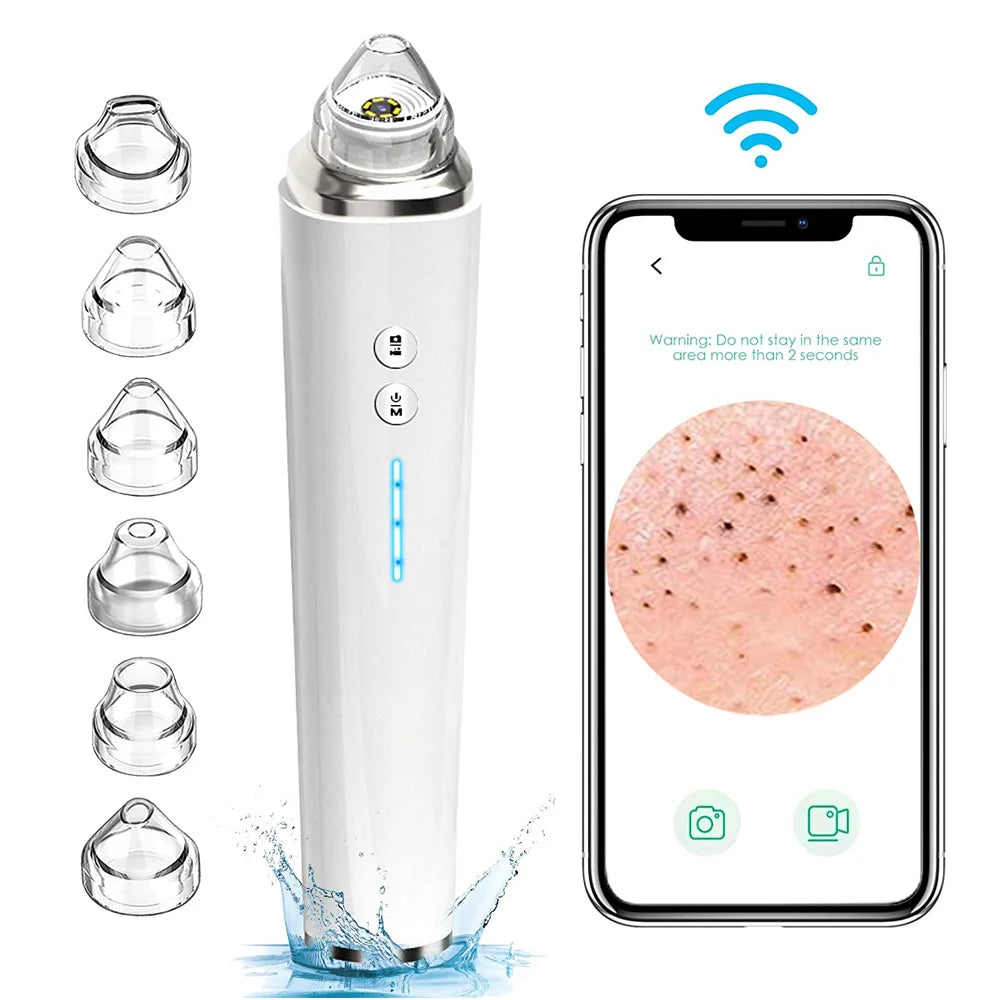 Mychway HD Camera Blackhead Remover With Light For Facial Cleaning
