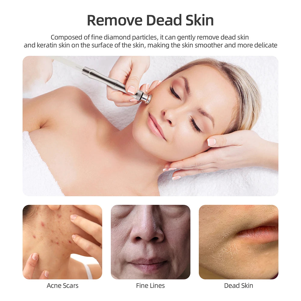 Foreverlily Diamond Microdermabrasion Machine for Skin Care