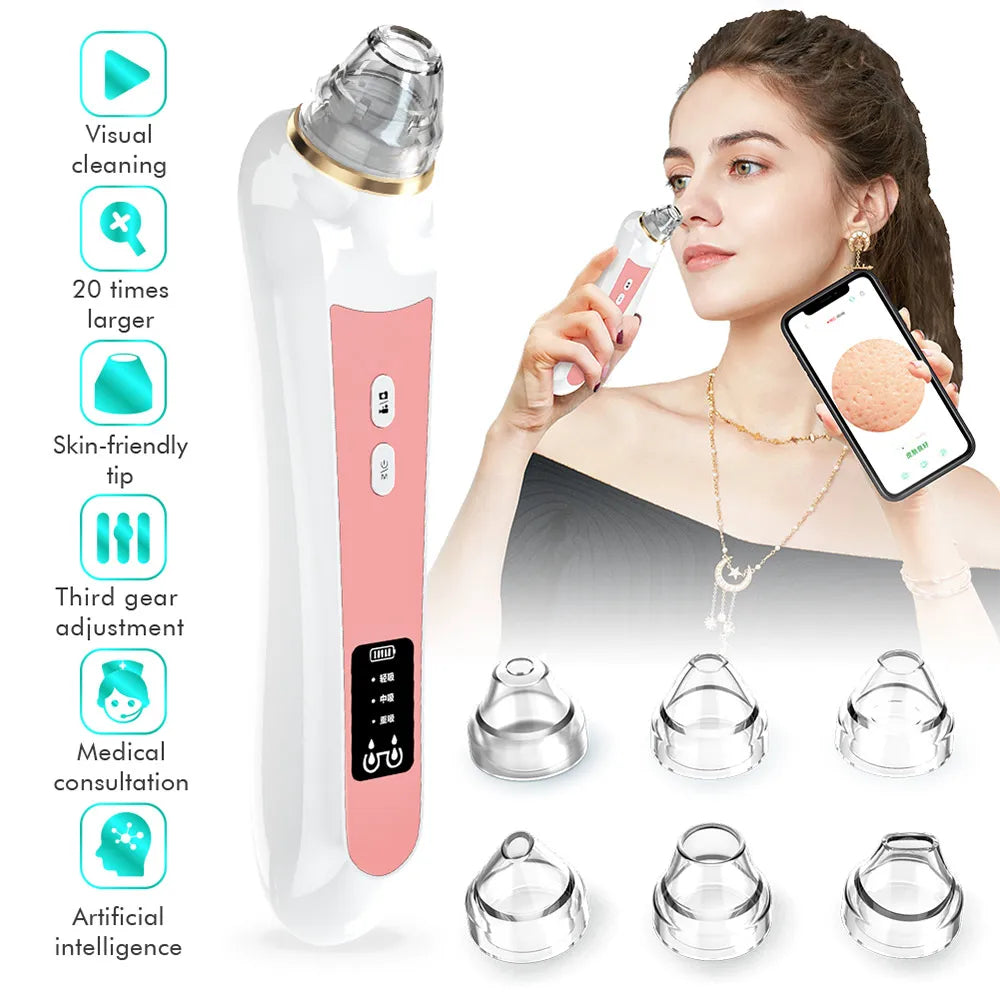 Mychway HD Camera Blackhead Remover With Light For Facial Cleaning