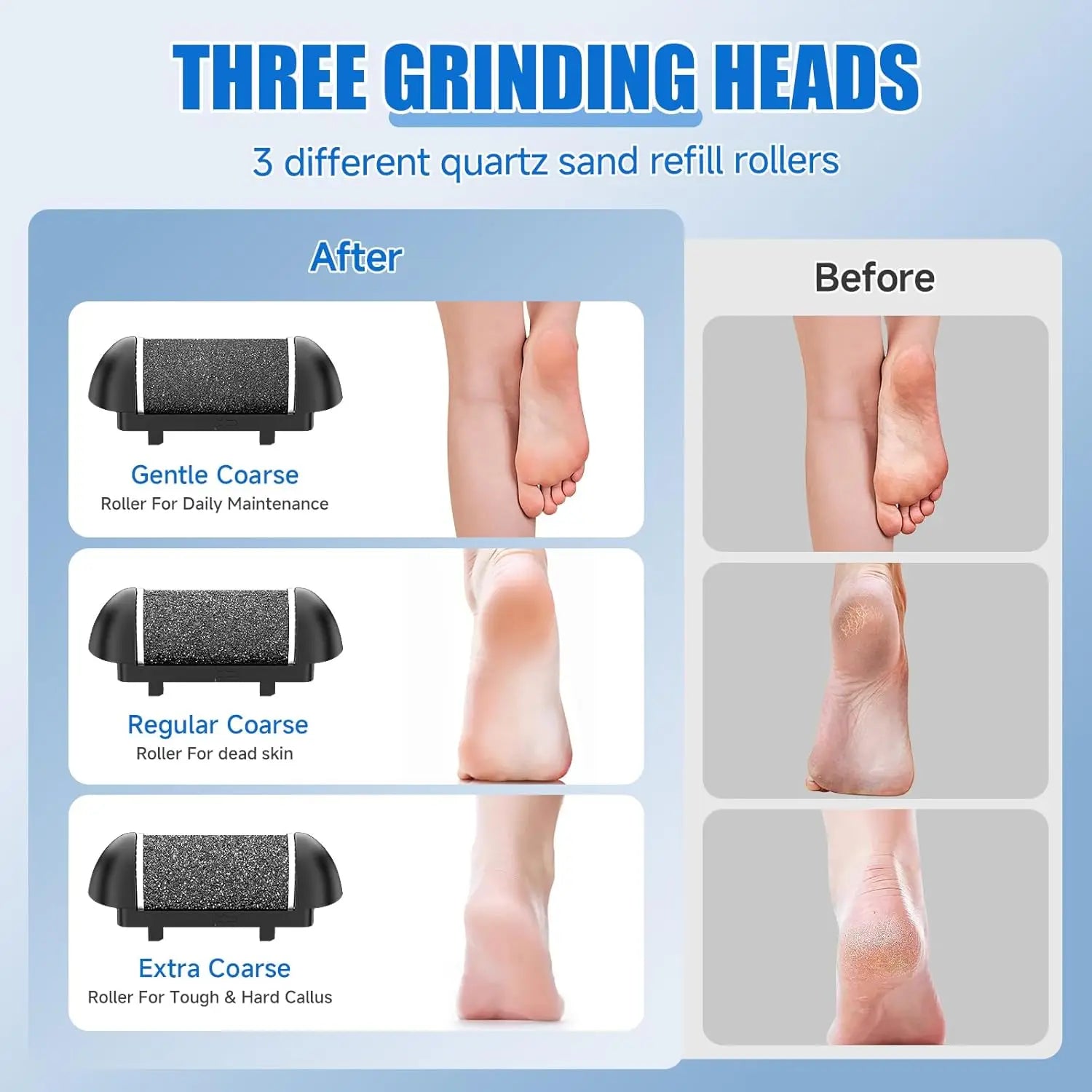 Electric Callus Remover 17 In 1 Pedicure Kit Rechargeable