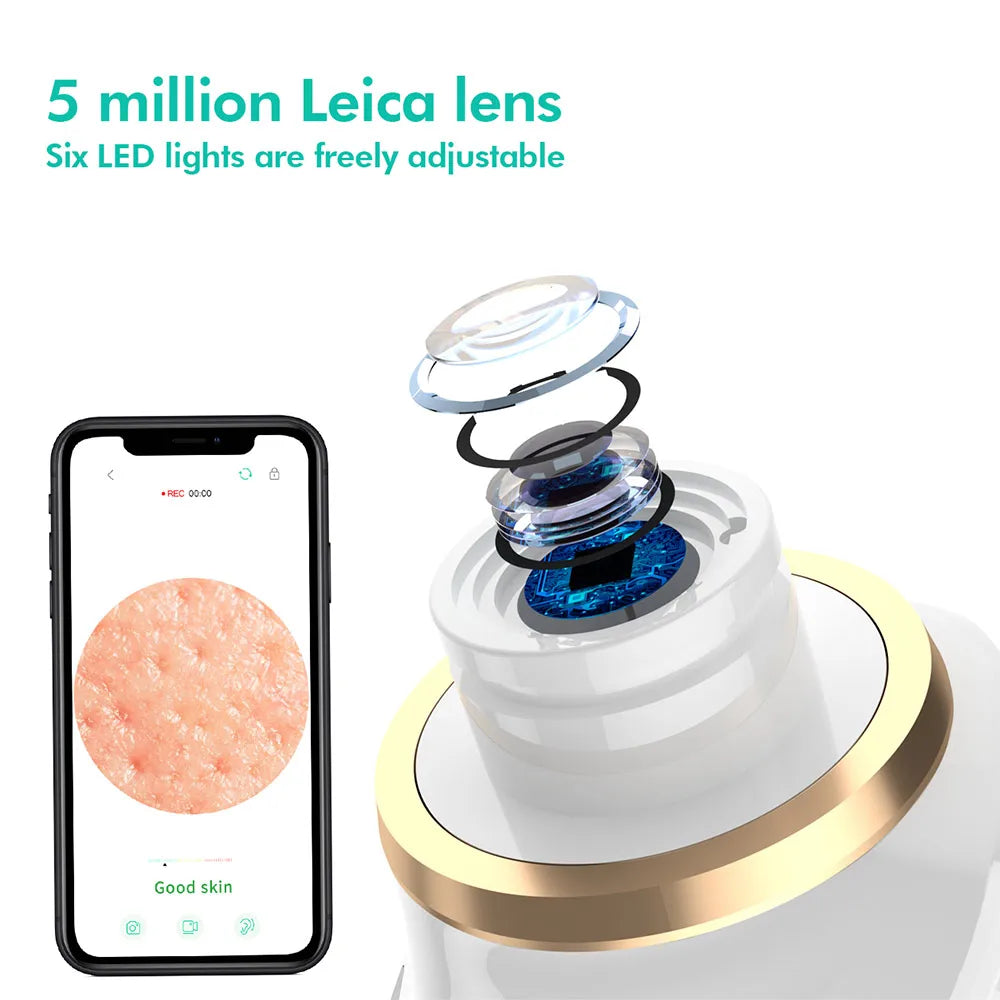 Mychway HD Camera Blackhead Remover With Light For Facial Cleaning