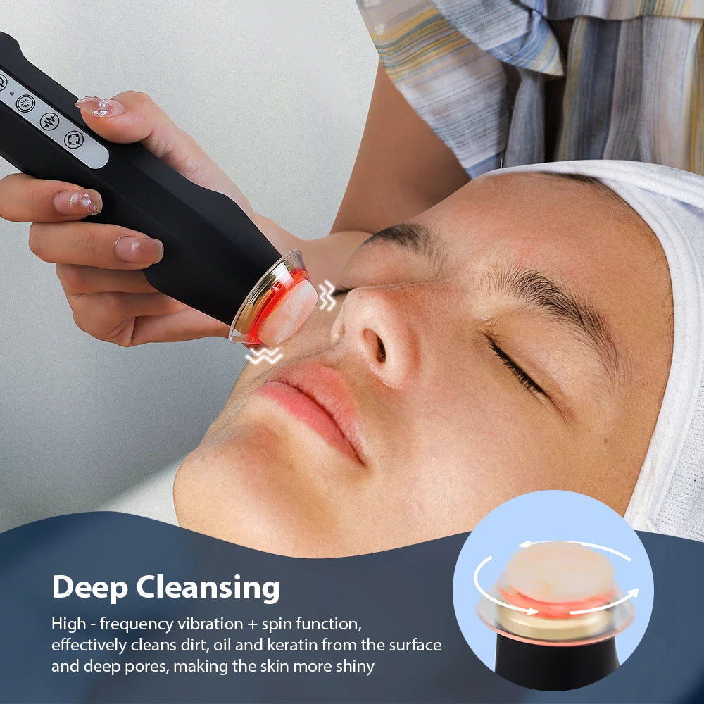 Foreverlily Oxygen Bubble Pen CO2 Facial Device For Skin Care