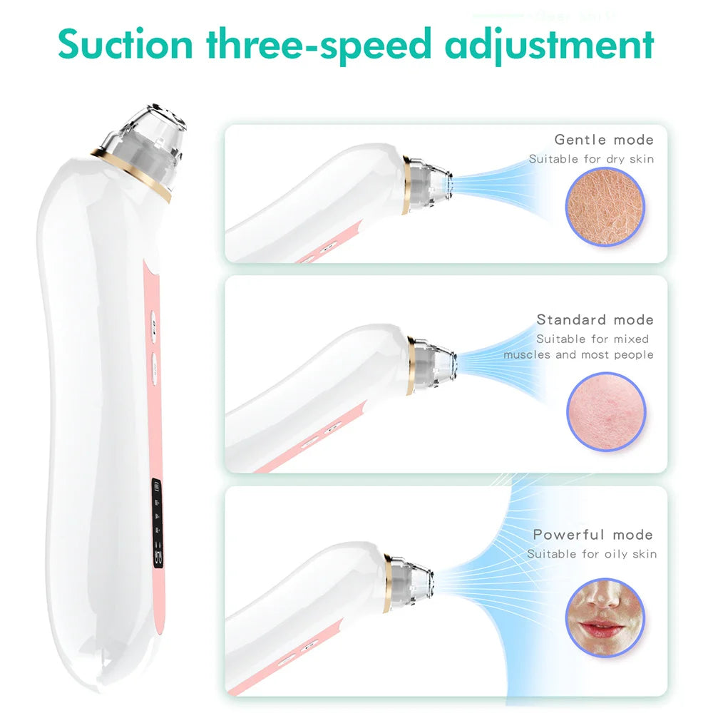 Mychway HD Camera Blackhead Remover With Light For Facial Cleaning