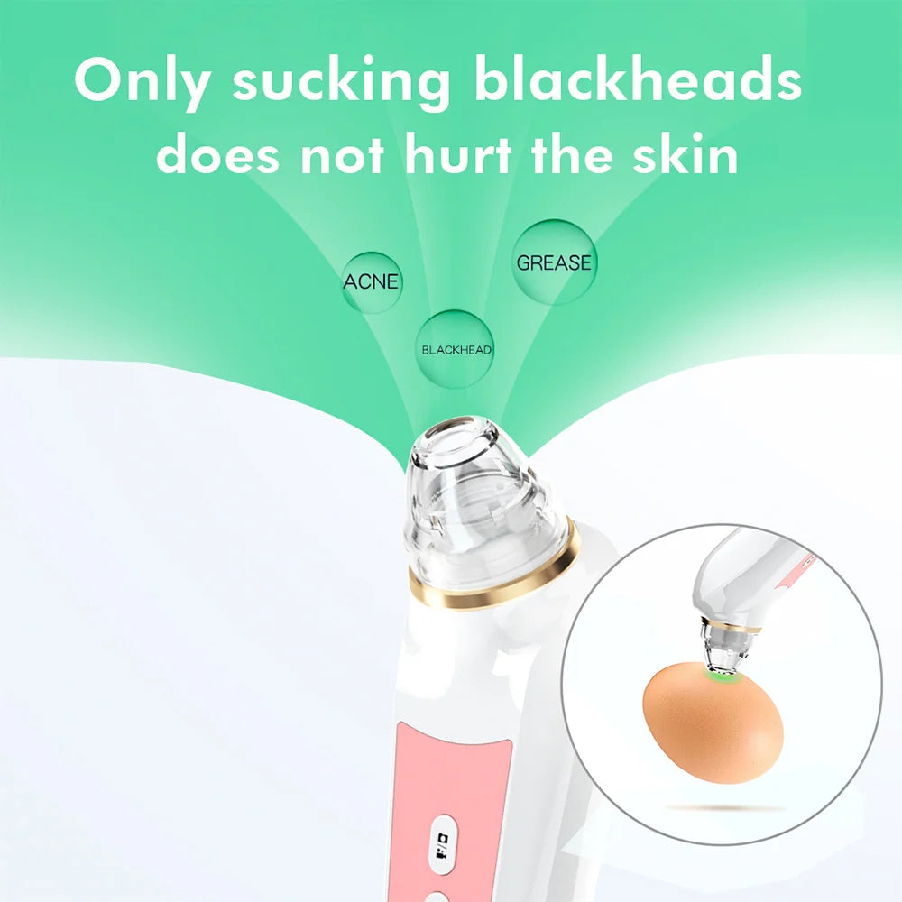 Mychway HD Camera Blackhead Remover With Light For Facial Cleaning