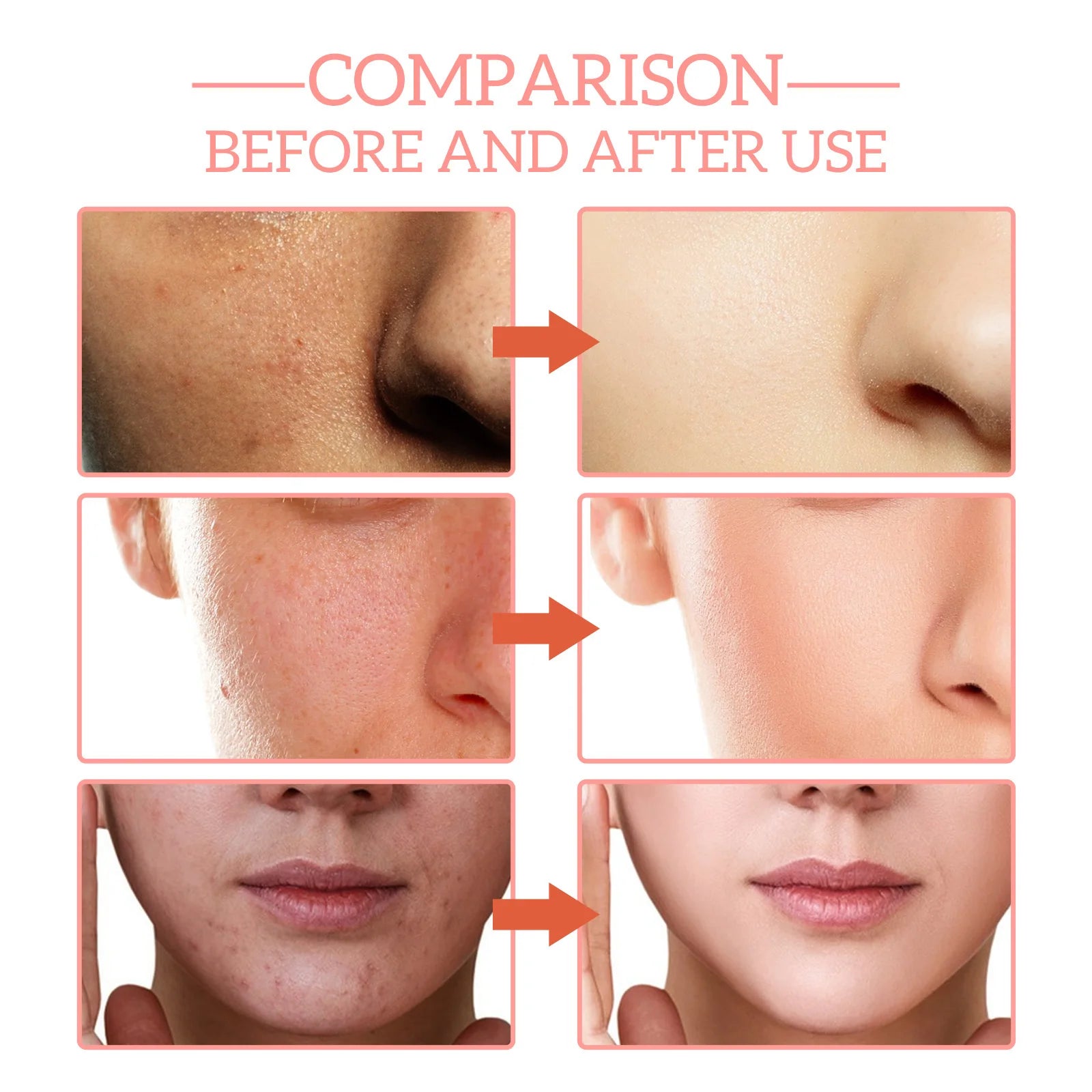 Jaysuing 5 In 1 AntiAging Facial Serum For Firming