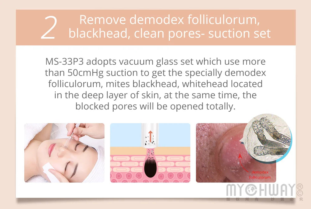 Mychway 3 In 1 Skin Care Ultrasound Dermabrasion Device